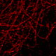 SR microscopy (STORM) image of Cy5-Cy3 labeled tubulin from A431 cell